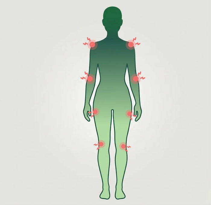 Joint pain diagram